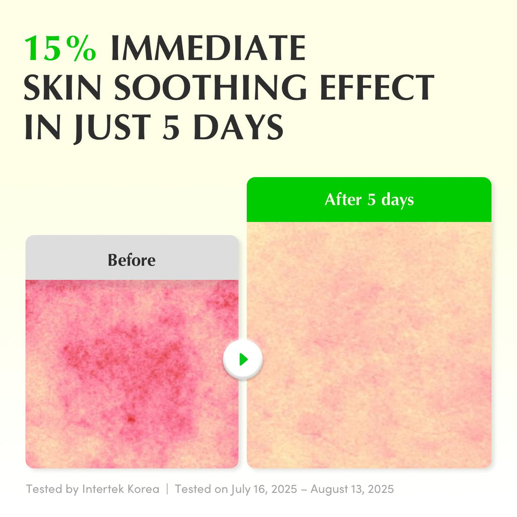 Eqqualberry - Aloe PDRN Calming Smoothie Serum