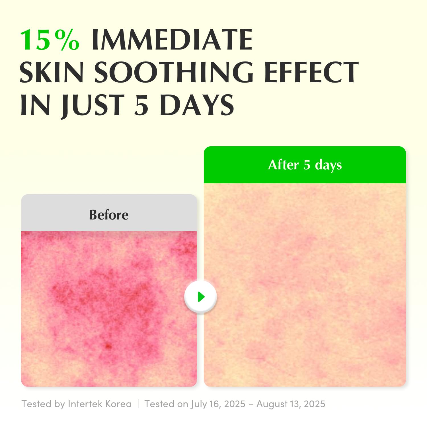 Eqqualberry - Aloe PDRN Calming Smoothie Serum
