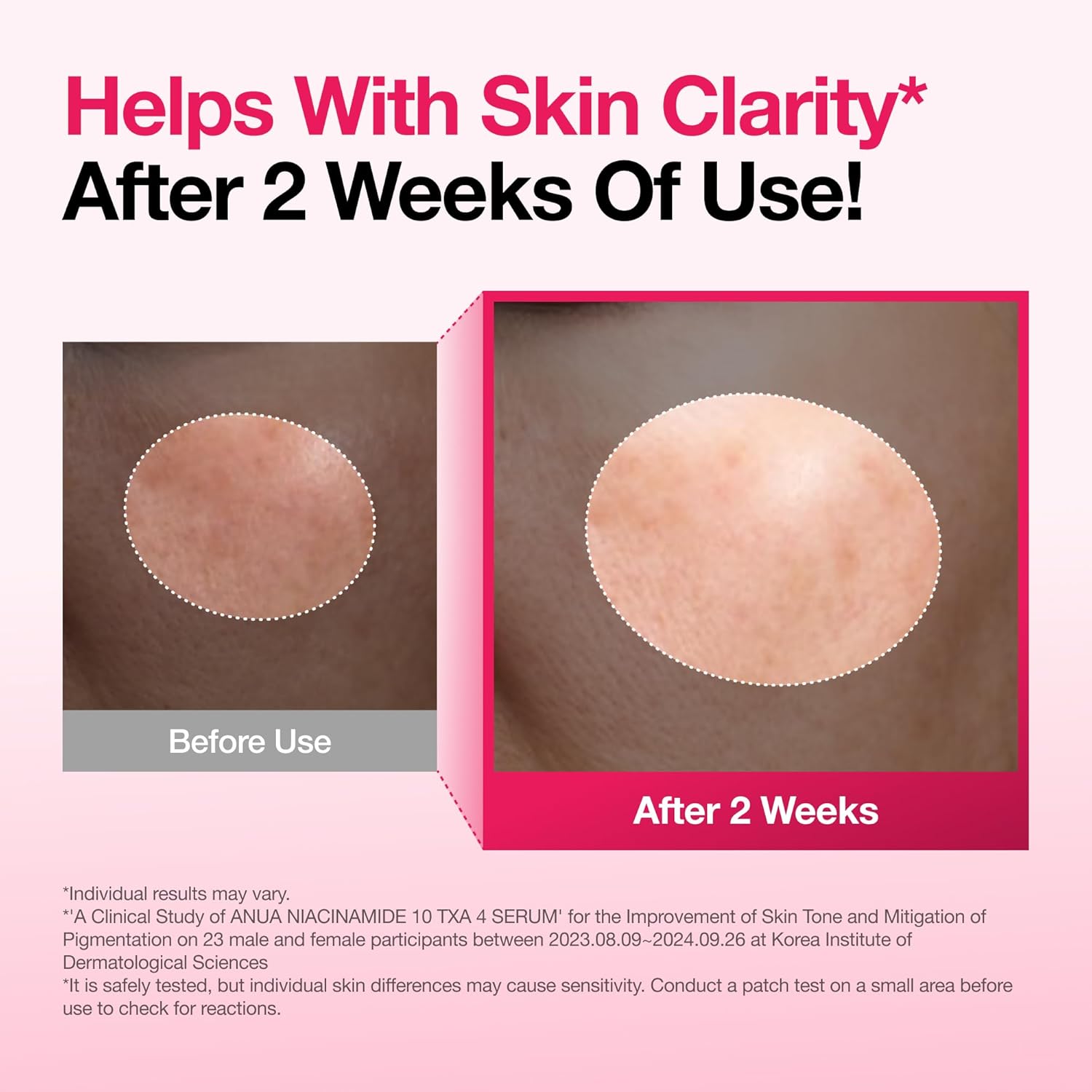 Anua - Niacinamide 10% + TXA 4% Serum